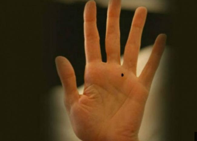 Letak Tahi Lalat Ini Menandakan Krisis Keuangan